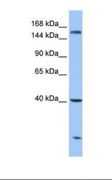 Hela cell lysate. Antibody concentration: 1.0 ug/ml. Gel concentration: 6-18%.