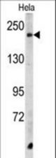 Western blot of CPD Antibody in HeLa cell line lysates (35 ug/lane). CPD (arrow) was detected using the purified antibody.