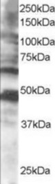 Antibody staining (0.5 ug/ml) of human brain lysate (RIPA buffer, 35 ug total protein per lane). Primary incubated for 1 hour. Detected by Western blot of chemiluminescence.