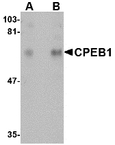Western blot of CPEB1 in rat brain tissue lysate with CPEB1 antibody at (A) 1 and (B) 2 ug/ml.