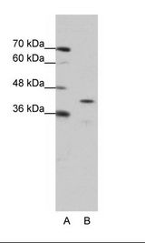 A: Marker, B: Jurkat Cell Lysate