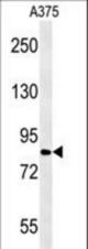 CPEB4 Antibody western blot of A375 cell line lysates (15 ug/lane). The CPEB4 antibody detected the CPEB4 protein (arrow).