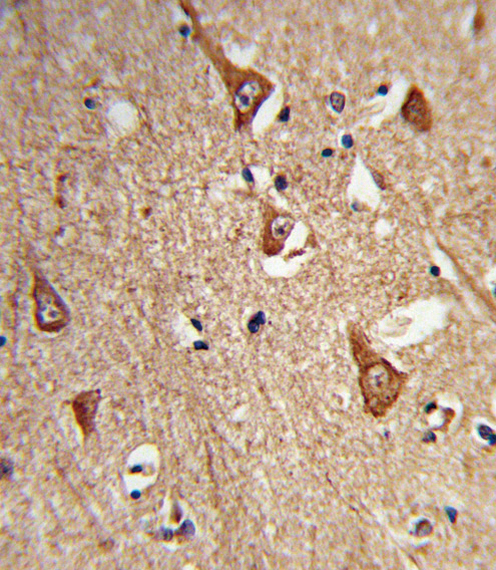 Formalin-fixed and paraffin-embedded human brain tissue reacted with CPLX1 Antibody , which was peroxidase-conjugated to the secondary antibody, followed by DAB staining. This data demonstrates the use of this antibody for immunohistochemistry; clinical relevance has not been evaluated.