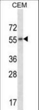 CHRM2 Antibody western blot of CEM cell line lysates (35 ug/lane). The CHRM2 antibody detected the CHRM2 protein (arrow).
