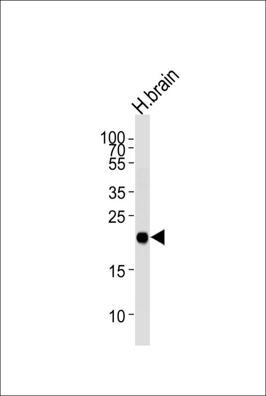 Western blot of lysate from human brain tissue lysate, using CPLX3 Antibody. Antibody was diluted at 1:1000 at each lane. A goat anti-rabbit IgG H&L (HRP) at 1:5000 dilution was used as the secondary antibody. Lysate at 35ug per lane.