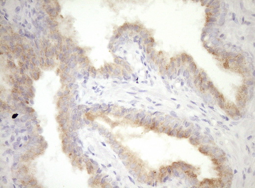 IHC of paraffin-embedded Human prostate tissue using anti-CPM mouse monoclonal antibody. (Heat-induced epitope retrieval by Tris-EDTA, pH8.0)(1:150).
