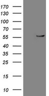 HEK293T cells were transfected with the pCMV6-ENTRY control (Left lane) or pCMV6-ENTRY CPM (Right lane) cDNA for 48 hrs and lysed. Equivalent amounts of cell lysates (5 ug per lane) were separated by SDS-PAGE and immunoblotted with anti-CPM (1:500).