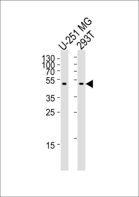 Western blot of lysates from U-251 MG, 293T cell line (from left to right), using CPM Antibody. Antibody was diluted at 1:1000 at each lane. A goat anti-rabbit IgG H&L (HRP) at 1:5000 dilution was used as the secondary antibody. Lysates at 35ug per lane.
