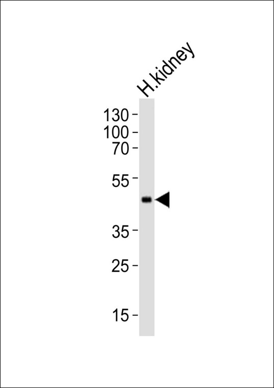 Western blot of lysate from human kidney tissue lysate, using CPM Antibody. Antibody was diluted at 1:1000. A goat anti-rabbit IgG H&L (HRP) at 1:5000 dilution was used as the secondary antibody. Lysate at 35ug.