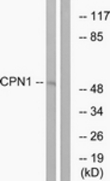 Western blot of extracts from RAW264.7 cells, using CPN1 Antibody. The lane on the right is treated with the synthesized peptide.