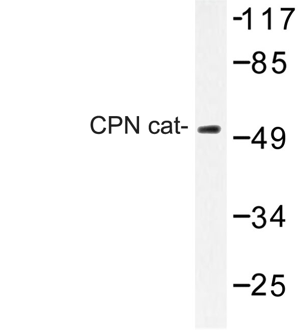Western blot of CPN antibody in extracts from RAW264.7 cells.