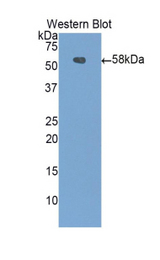 Western blot of recombinant CPN1 / ACBP.