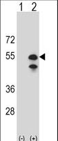Western blot of CPN1 (arrow) using rabbit polyclonal CPN1 Antibody. 293 cell lysates (2 ug/lane) either nontransfected (Lane 1) or transiently transfected (Lane 2) with the CPN1 gene.