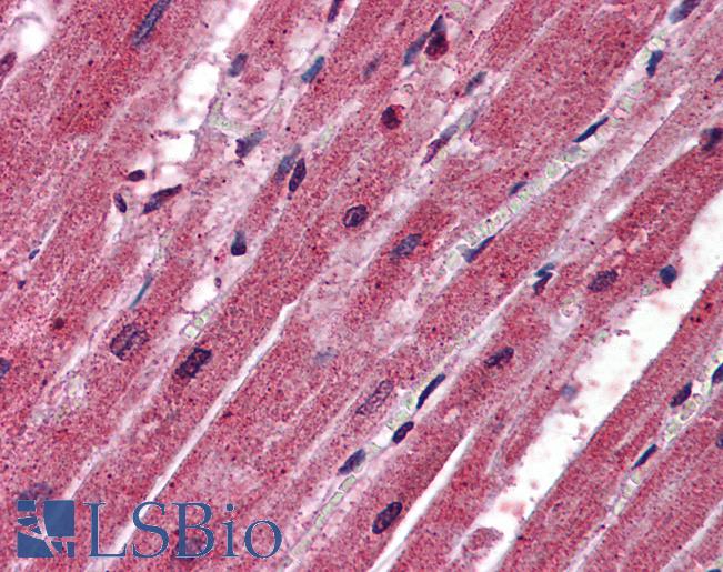 Anti-CPN1 antibody IHC of human heart. Immunohistochemistry of formalin-fixed, paraffin-embedded tissue after heat-induced antigen retrieval. Antibody LS-B5828 concentration 2.5 ug/ml.