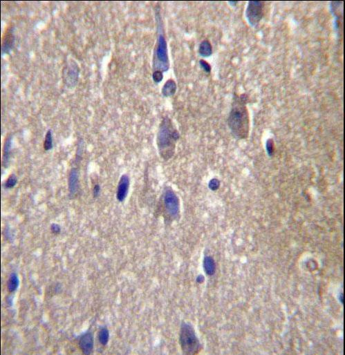 CPN2 Antibody immunohistochemistry of formalin-fixed and paraffin-embedded human brain tissue followed by peroxidase-conjugated secondary antibody and DAB staining.