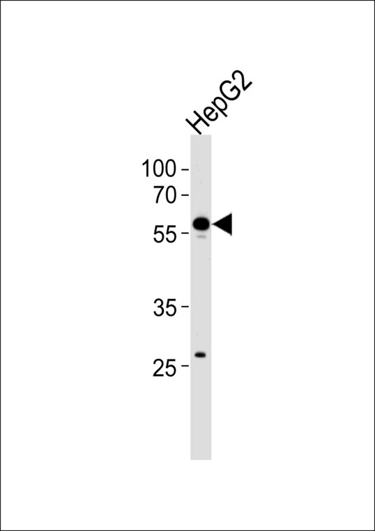 Western blot of lysate from HepG2 cell line, using CPN2 Antibody. Antibody was diluted at 1:1000 at each lane. A goat anti-rabbit IgG H&L (HRP) at 1:5000 dilution was used as the secondary antibody. Lysate at 35ug per lane.