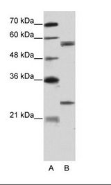A: Marker, B: HepG2 Cell Lysate