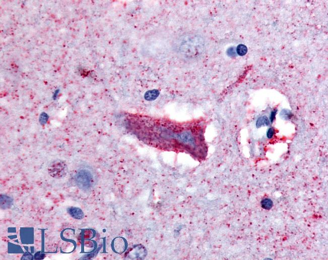 Anti-CHRM3 / M3 antibody LS-A1422 IHC of human brain, cortex. Immunohistochemistry of formalin-fixed, paraffin-embedded tissue after heat-induced antigen retrieval.