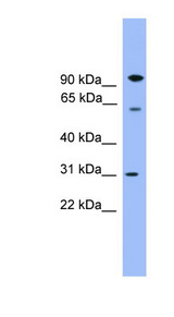 CPNE6 antibody LS-C135524 Western blot of Fetal Brain lysate.