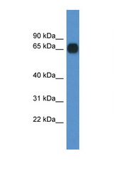 CPNE6 antibody LS-C145292 Western blot of Mouse Pancreas lysate. Antibody concentration 1 ug/ml.