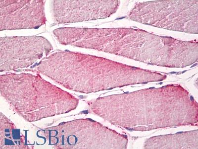 Anti-CPNE6 / N-COPINE antibody IHC staining of human skeletal muscle. Immunohistochemistry of formalin-fixed, paraffin-embedded tissue after heat-induced antigen retrieval.