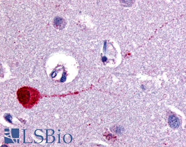 Anti-CHRM3 / M3 antibody LS-A1423 IHC of human brain, cortex. Immunohistochemistry of formalin-fixed, paraffin-embedded tissue after heat-induced antigen retrieval.