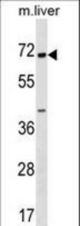 CPNE6 Antibody western blot of mouse liver tissue lysates (35 ug/lane). The CPNE6 antibody detected the CPNE6 protein (arrow).