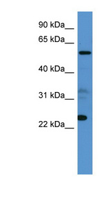 CPNE9 antibody LS-C135012 Western blot of 721_B cell lysate.