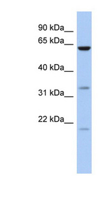 CPNE9 antibody LS-C111491 Western blot of 721_B cell lysate.