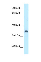 CPPED1 antibody LS-C145749 Western blot of Placenta lysate. Antibody concentration 1 ug/ml.