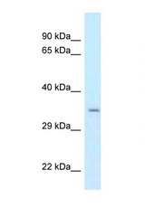 CPPED1 antibody LS-C145779 Western blot of HeLa Cell lysate. Antibody concentration 1 ug/ml.