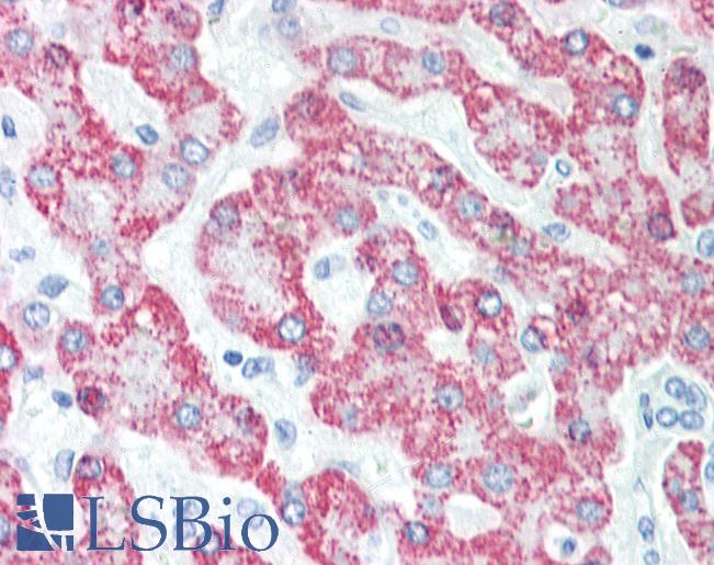 Anti-CPS1 antibody IHC staining of human liver. Immunohistochemistry of formalin-fixed, paraffin-embedded tissue after heat-induced antigen retrieval.