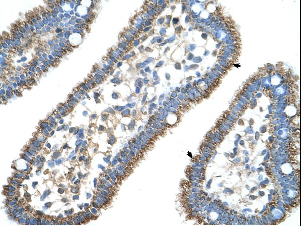 CPS1 antibody LS-C80753 was used in IHC to stain formalin-fixed, paraffin-embedded human intestine.