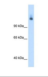 Fetal liver cell lysate. Antibody concentration: 1.25 ug/ml. Gel concentration: 8%.
