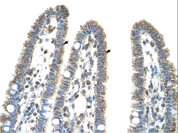 CPS1 antibody LS-C80754 was used in IHC to stain formalin-fixed, paraffin-embedded human intestine.