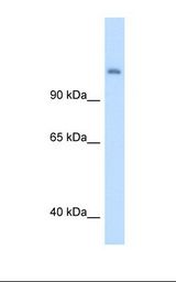 Fetal liver cell lysate. Antibody concentration: 5.0 ug/ml. Gel concentration: 8%.