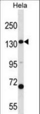 CPS1 Antibody western blot of HeLa cell line lysates (35 ug/lane). The CPS1 antibody detected the CPS1 protein (arrow).