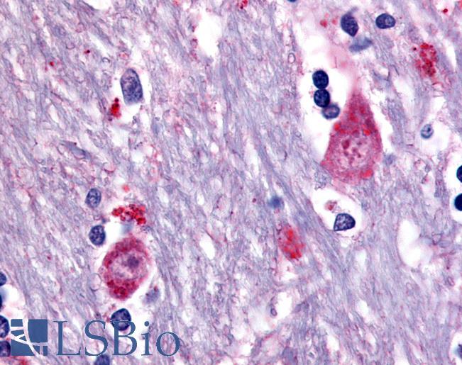 Anti-CHRM3 / M3 antibody LS-A5385 IHC of human brain, caudate. Immunohistochemistry of formalin-fixed, paraffin-embedded tissue after heat-induced antigen retrieval.