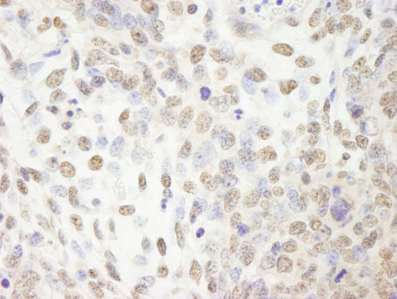 Detection of Mouse CPSF100 Immunohistochemistry. Sample: FFPE section of mouse teratoma. Antibody: Affinity purified rabbit anti-CPSF100 used at a dilution of 1:250.