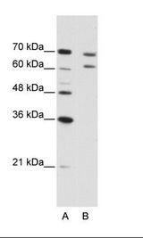 A: Marker, B: Jurkat Cell Lysate