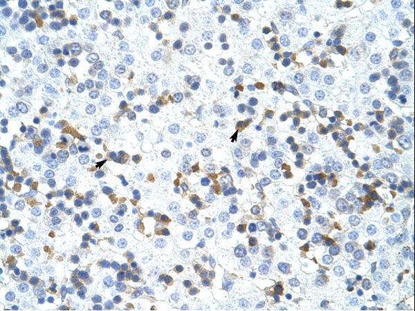 CPSF3 antibody LS-C31378 was used in IHC to stain formalin-fixed, paraffin-embedded human liver.