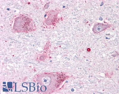 Anti-CHRM3 / M3 antibody LS-A5259 IHC of human brain, neurons and glia. Immunohistochemistry of formalin-fixed, paraffin-embedded tissue after heat-induced antigen retrieval.