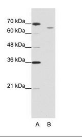 B: Jurkat Cell Lysate