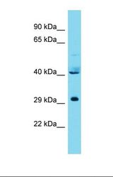 Western blot of Human 721_B. CPSF3L antibody dilution 1.0 ug/ml.