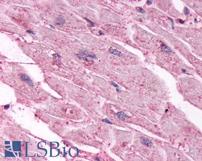 Anti-CHRM3 / M3 antibody IHC of human heart. Immunohistochemistry of formalin-fixed, paraffin-embedded tissue after heat-induced antigen retrieval.