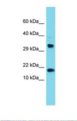 Western blot of Human 293T. CPSF4L antibody dilution 1.0 ug/ml.