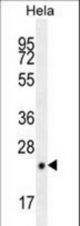 CPSF4L Antibody western blot of HeLa cell line lysates (35 ug/lane). The CPSF4L antibody detected the CPSF4L protein (arrow).