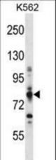 CPT1A Antibody western blot of K562 cell line lysates (35 ug/lane). The CPT1A antibody detected the CPT1A protein (arrow).