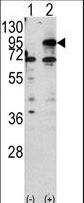 Western blot of CPT1B (arrow) using rabbit polyclonal CPT1B Antibody. 293 cell lysates (2 ug/lane) either nontransfected (Lane 1) or transiently transfected with the CPT1B gene (Lane 2).