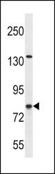 CPT1B Antibody western blot of SK-BR-3 cell line lysates (35 ug/lane). The CPT1B antibody detected the CPT1B protein (arrow).